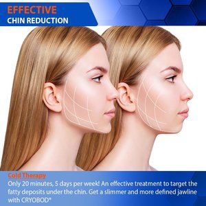 CRYOBOD Double Chin Face Slimming Wrap–Premium Fat Freezing Chin Reducer